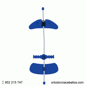 EXPANSOR DENTAL