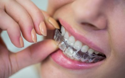 Invisible Orthodontics for Adults: The Discreet Solution to Dental Problems