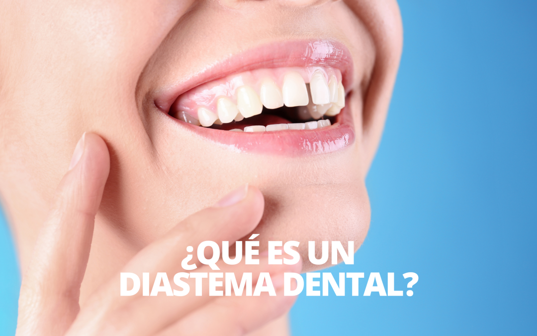 Diastema:Causes, treatment, and prevetion