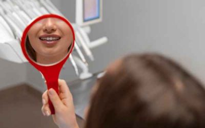 Beneficios del blanqueamiento dental después de ortodoncia