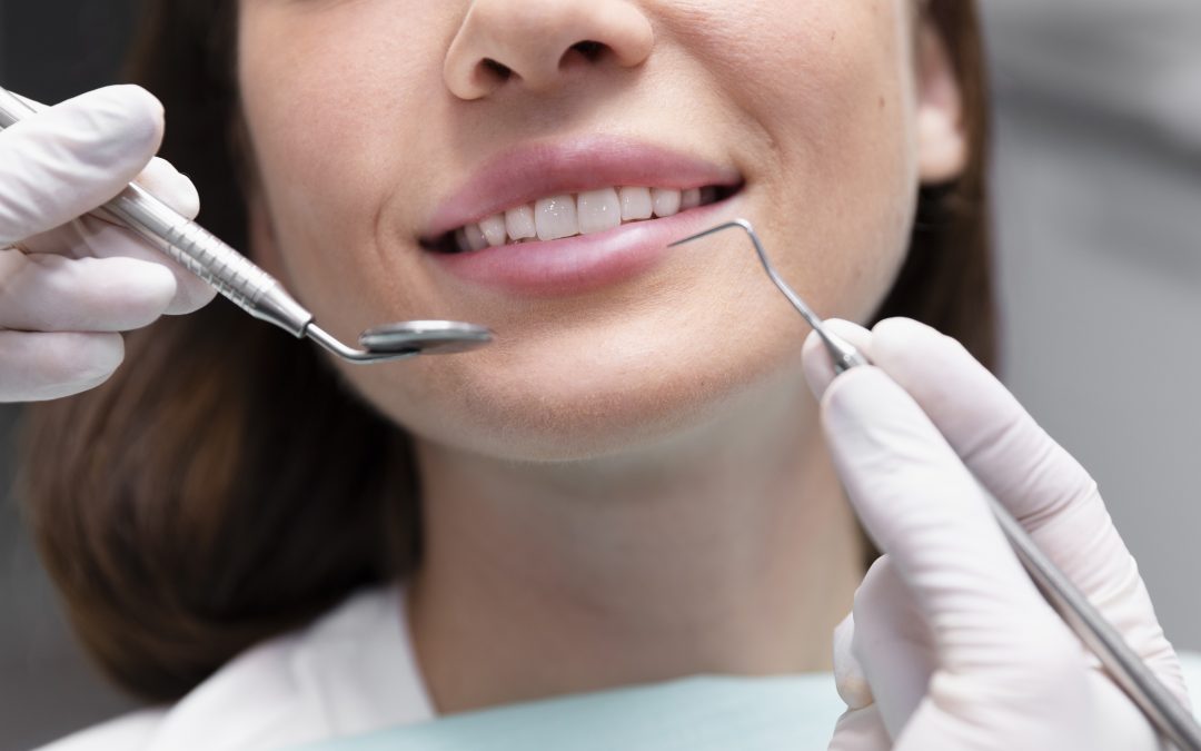 limpieza dental malaga