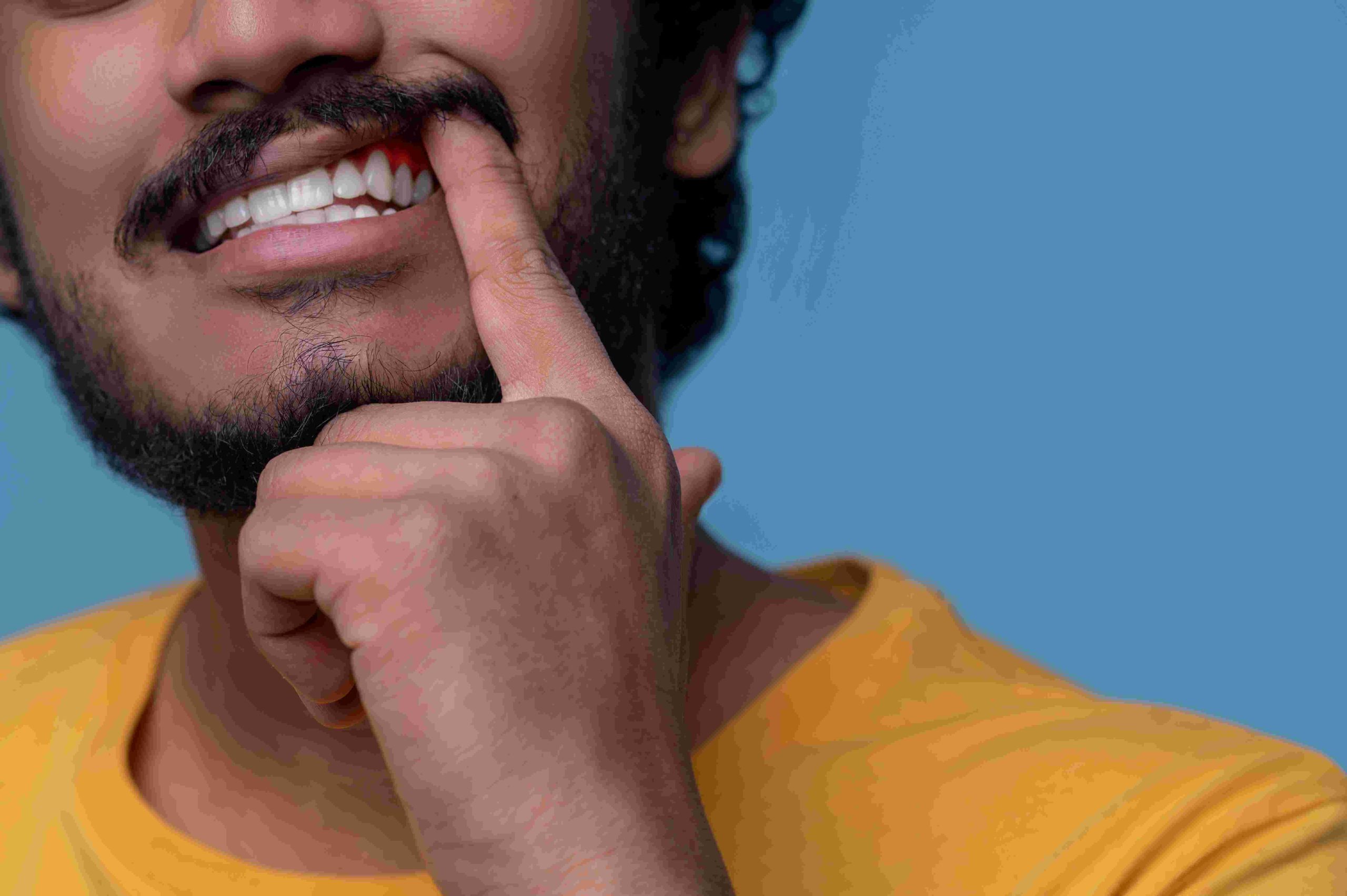 recesión de encías malaga