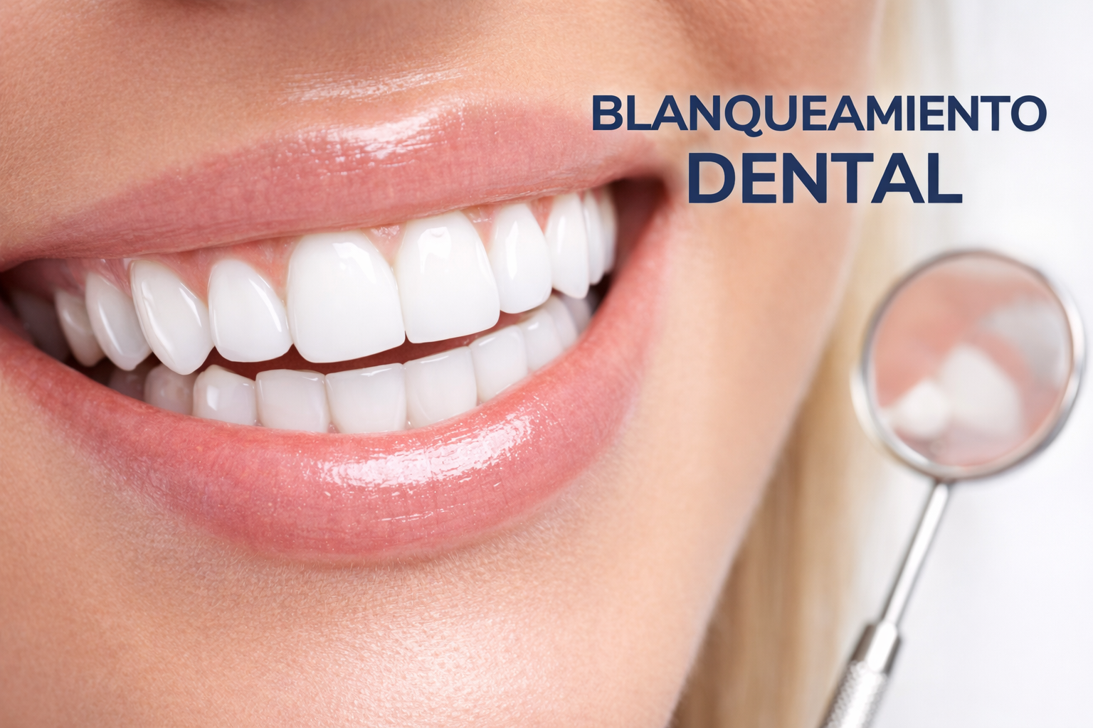BLANQUEAMIENTO DENTAL EN MALAGA