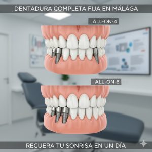 implante dental malaga all in 4
