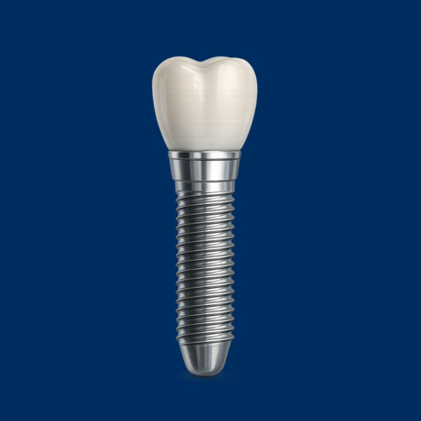 implante unitario malaga