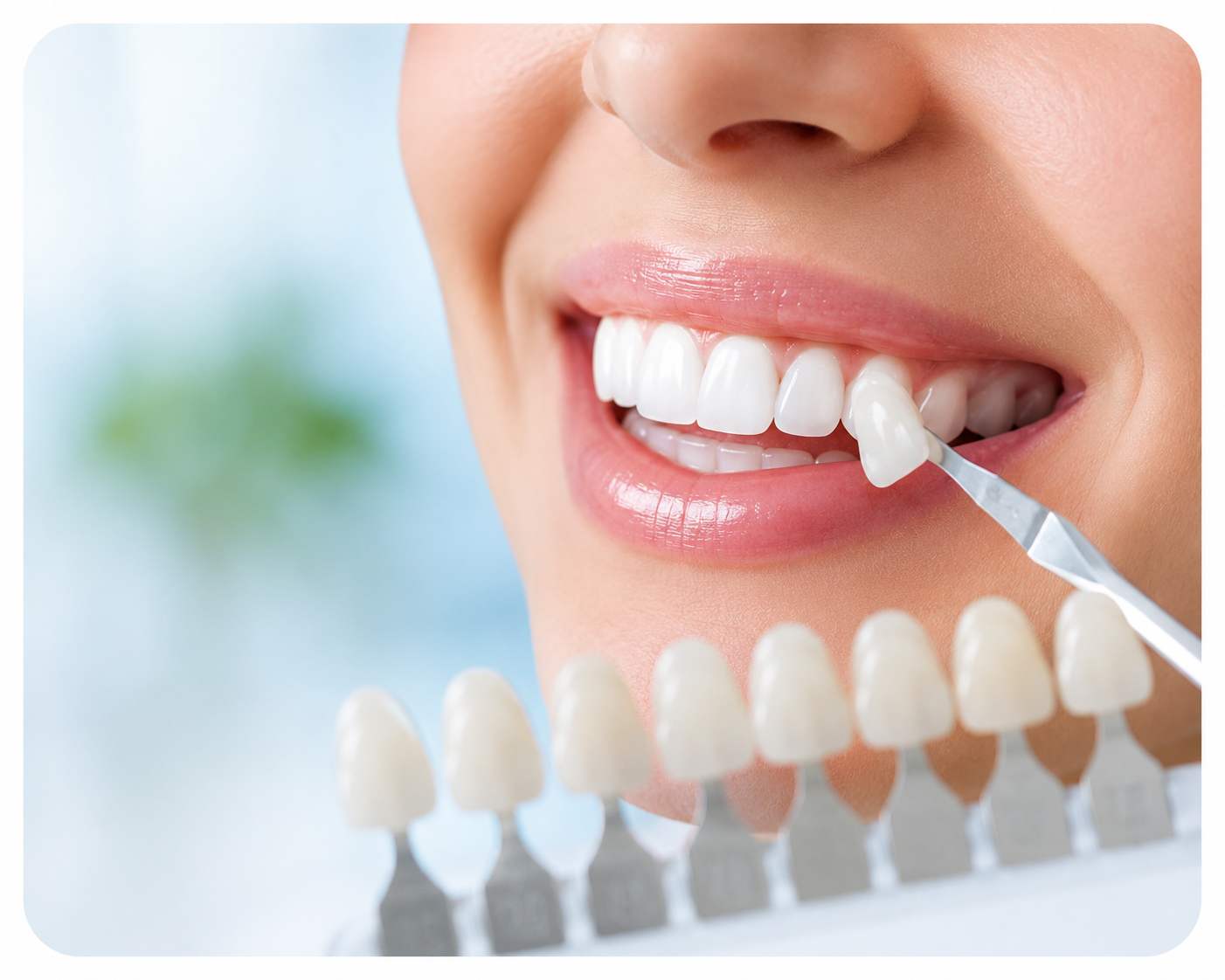 blanqueamiento dental en malaga