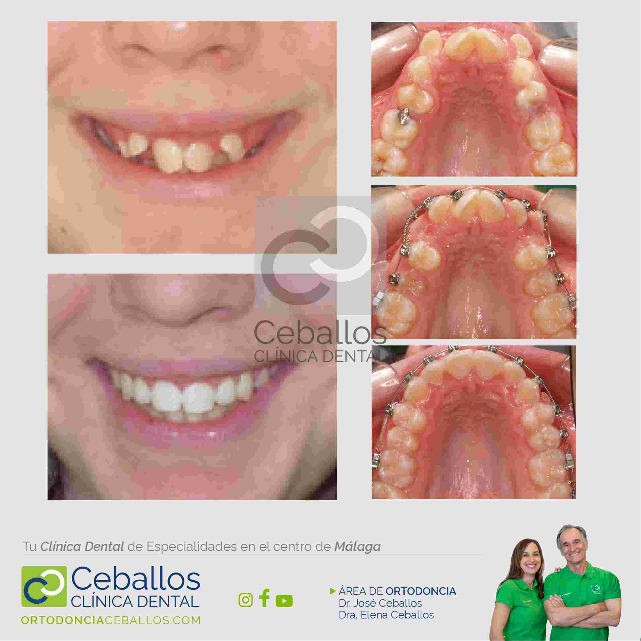 clinica dental en Málaga