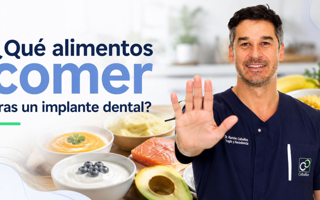 ¿Qué comer después de un implante dental? Guía completa de alimentación