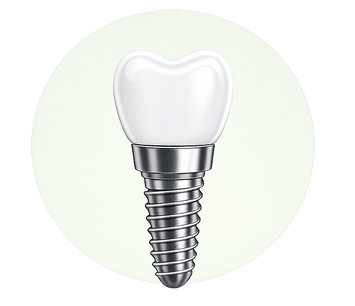implante dental en malaga