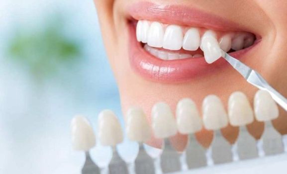 blanqueamientodentalenMálaga